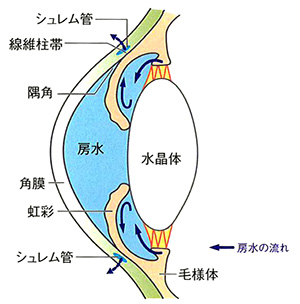 原発閉塞隅角緑内障