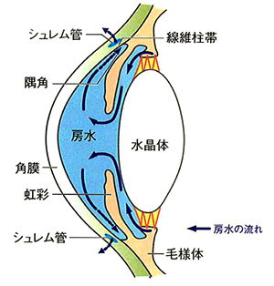 原発開放隅角緑内障